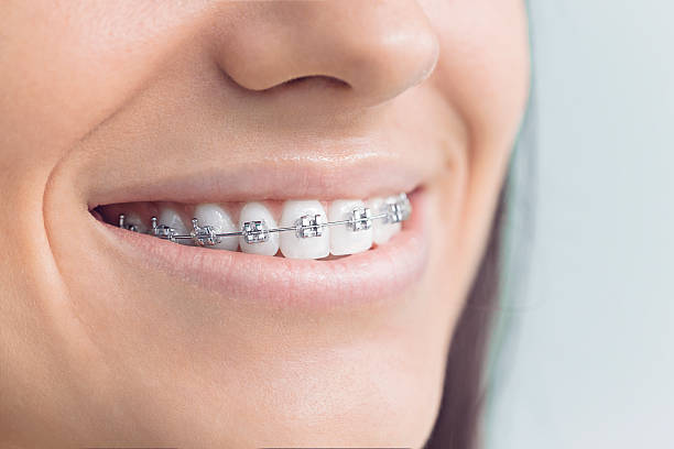 Best Periodontal (Gum) Disease Treatment  in Marion Oaks, FL